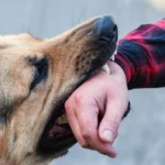 Dog Bite Accident Lawyers in Las Vegas