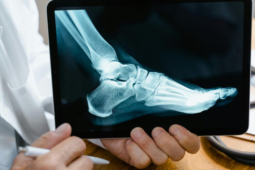 Slip and Fall Accident Attorney henderson