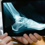Slip and Fall Accident Attorney henderson