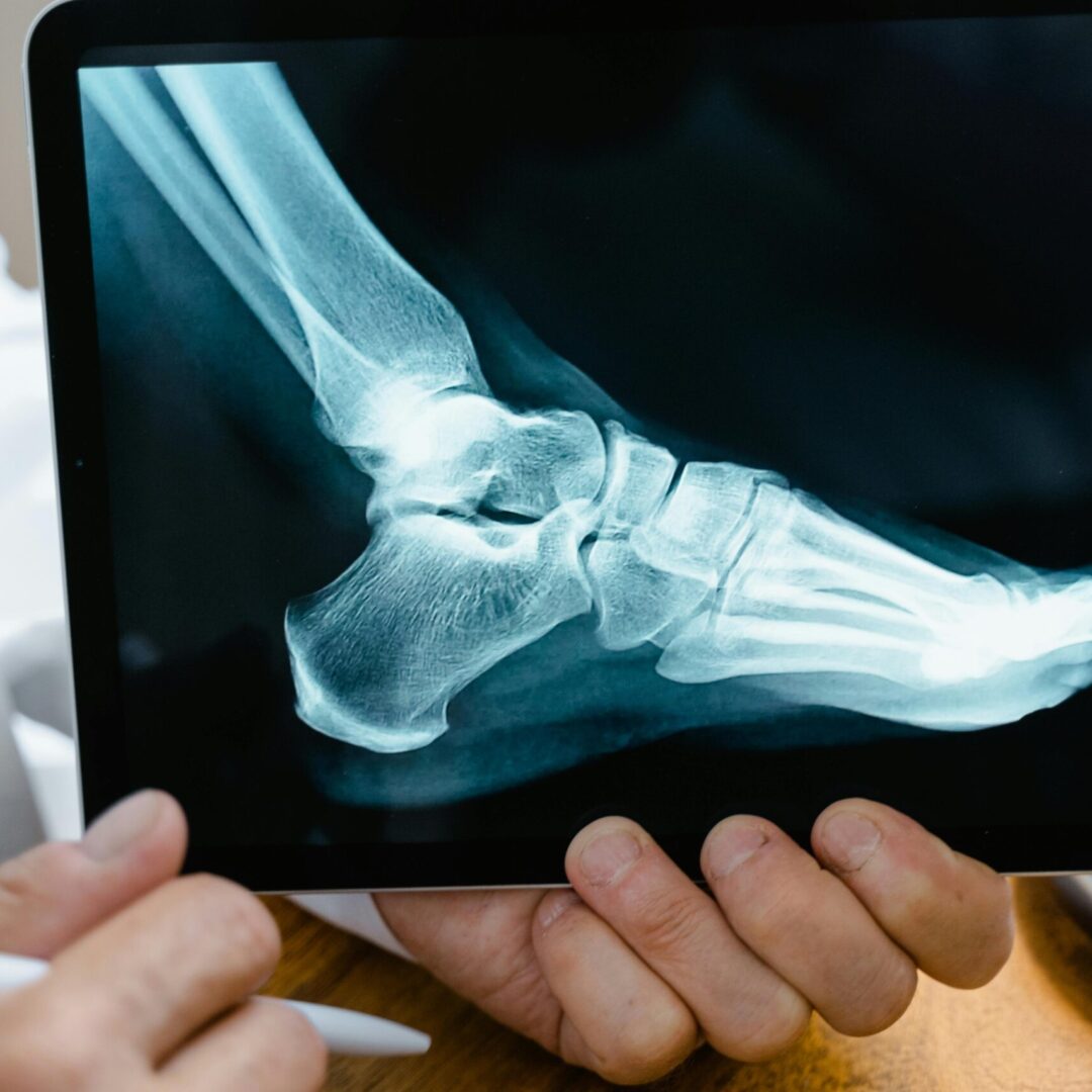 Slip and Fall Accident Attorney henderson