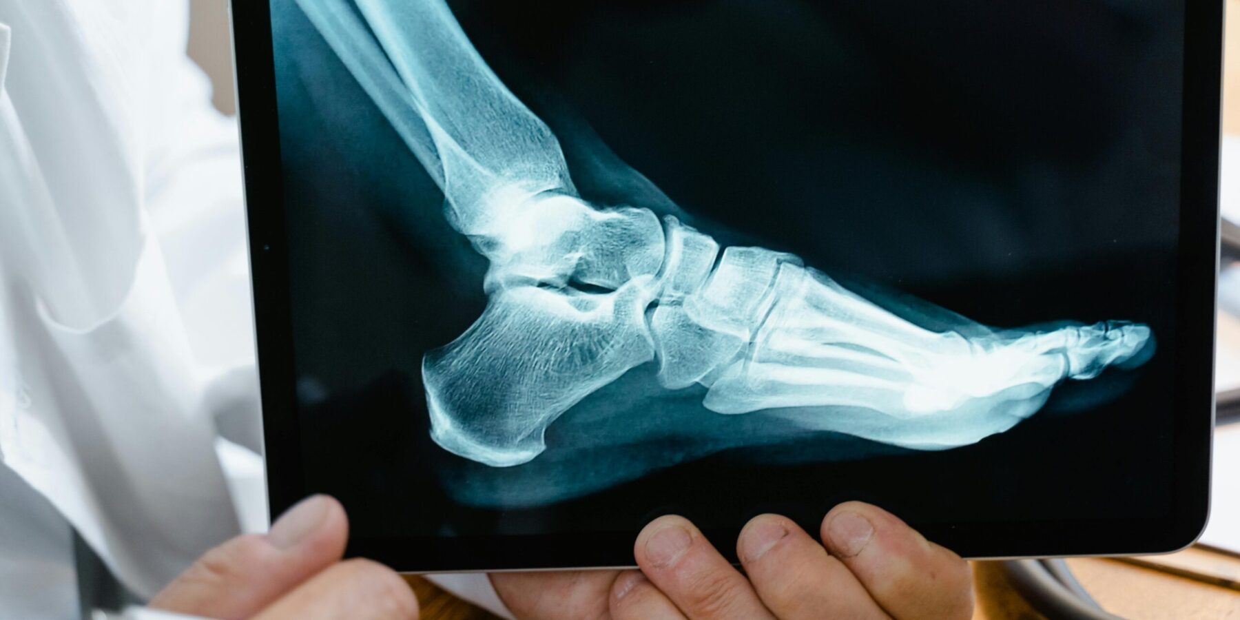 Slip and Fall Accident Attorney henderson